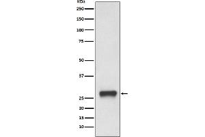 Western blot analysis of MHC Class II expression in Daudi cell lysate.