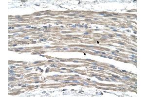 GPR161 antibody was used for immunohistochemistry at a concentration of 4-8 ug/ml to stain Skeletal muscle cells (arrows) in Human Muscle. (GPR161 antibody  (Middle Region))