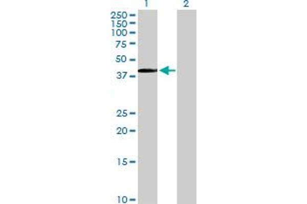 PITX1 antibody  (AA 1-314)