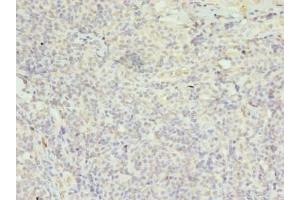 Immunohistochemistry of paraffin-embedded human tonsil tissue using ABIN7152974 at dilution of 1:100 (FPR1 antibody  (AA 306-350))
