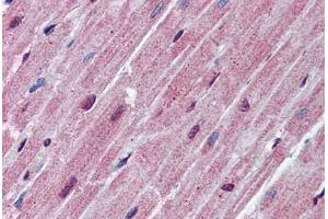 Human Heart: Formalin-Fixed, Paraffin-Embedded (FFPE) (SPNS2 antibody  (AA 71-120))