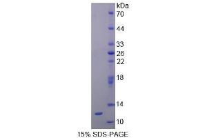 SDS-PAGE (SDS) image for Renin (REN) (AA 144-237) protein (His tag) (ABIN1171274) (Renin Protein (REN) (AA 144-237) (His tag))