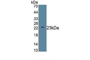 Detection of Recombinant LAMC2, Human using Monoclonal Antibody to Laminin Gamma 2 (LAMC2) (LAMC2 antibody  (AA 28-196))