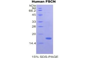 SDS-PAGE analysis of Human Fascin Protein. (Fascin Protein (FSCN1))