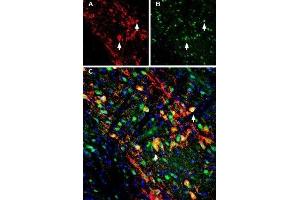 KCNJ6 antibody  (C-Term, Intracellular)