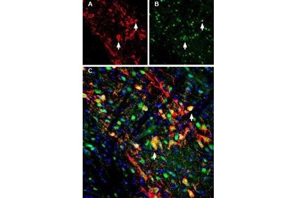 KCNJ6 antibody  (C-Term, Intracellular)