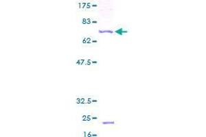 TIMM13 Protein (AA 1-95) (GST tag)