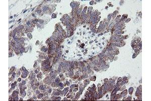 Image no. 2 for anti-Platelet/endothelial Cell Adhesion Molecule (PECAM1) antibody (ABIN1497246) (CD31 antibody)
