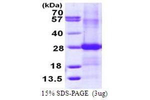 SDS-PAGE (SDS) image for Ephrin B2 (EFNB2) (AA 28-229) protein (His tag) (ABIN667564)