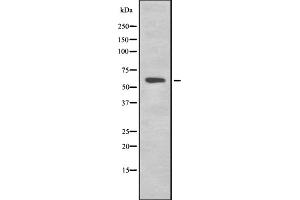 Western blot analysis of K2C1B expression in HEK293 cells ,The lane on the left is treated with the antigen-specific peptide. (Keratin 77 antibody  (Internal Region))