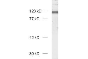 dilution: 1 : 1000, sample: synaptic membrane fraction of rat brain (LP1) (NMDA 1 Receptor antibody  (AA 35-53))