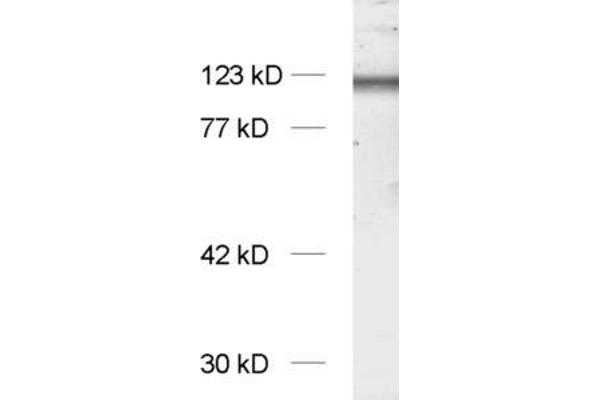 NMDA 1 Receptor 抗体  (AA 35-53)