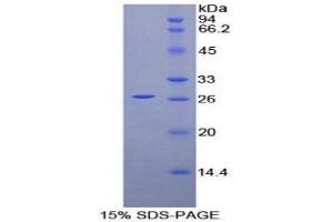SDS-PAGE (SDS) image for Prion Protein (PRNP) (AA 23-230) protein (His tag) (ABIN1879058)