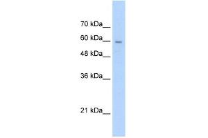 WB Suggested Anti-SLC22A1 Antibody Titration:  2. (SLC22A1 antibody  (N-Term))