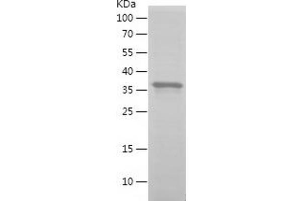 GOLM1 Protein (AA 101-401) (His tag)