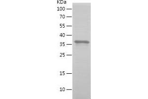 Western Blotting (WB) image for Golgi Membrane Protein 1 (GOLM1) (AA 101-401) protein (His tag) (ABIN7123180) (GOLM1 Protein (AA 101-401) (His tag))