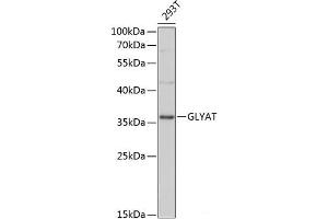 Western blot analysis of extracts of 293T cells using GLYAT Polyclonal Antibody at dilution of 1:3000.
