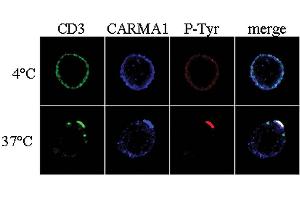 Immunocytochemistry analysis of CARMA1 using anti-CARMA1, pAb (AL220) . (CARD11 antibody  (N-Term))