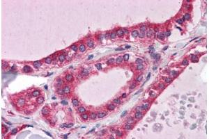 Human Thyroid: Formalin-Fixed, Paraffin-Embedded (FFPE) (WDR35 antibody  (N-Term))
