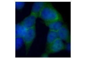 Immunofluorescence (IF) image for anti-DEAD (Asp-Glu-Ala-Asp) Box Polypeptide 1 (DDX1) antibody (ABIN2664923) (DDX1 antibody)
