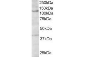Image no. 1 for anti-Hermansky-Pudlak Syndrome 3 (HPS3) (C-Term) antibody (ABIN374450) (HPS3 antibody  (C-Term))