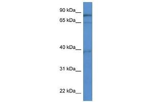 Western Blot showing ZCCHC7 antibody used at a concentration of 1-2 ug/ml to detect its target protein. (ZCCHC7 antibody  (C-Term))