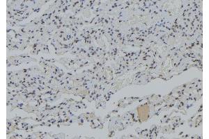 ABIN6279399 at 1/100 staining Human lung tissue by IHC-P. (PJA1 antibody  (Internal Region))