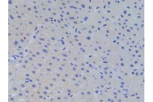 Figure. (RFTN1 antibody  (AA 288-520))