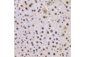 Immunohistochemistry of paraffin-embedded Mouse liver using HMGB1 antibody at dilution of 1:100 (x400 lens). (HMGB1 antibody  (AA 100-200))