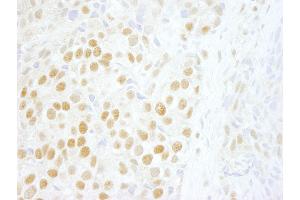 Immunohistochemistry (IHC) image for anti-Zinc Finger, MYM-Type 2 (ZMYM2) (AA 1327-1377) antibody (ABIN7448880)