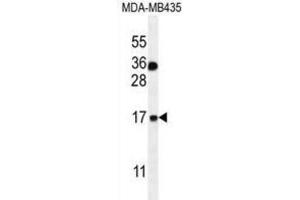 Western Blotting (WB) image for anti-S100 Calcium Binding Protein A1 (S100A1) antibody (ABIN2996370)