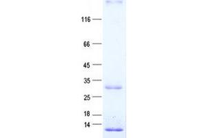 Validation with Western Blot (OIP5 Protein (His tag))