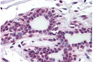 Human Breast (formalin-fixed, paraffin-embedded) stained with ZMYM2 antibody ABIN297886 at 10 ug/ml followed by biotinylated goat anti-rabbit IgG secondary antibody ABIN481713, alkaline phosphatase-streptavidin and chromogen. (ZMYM2 antibody  (AA 1250-1300))