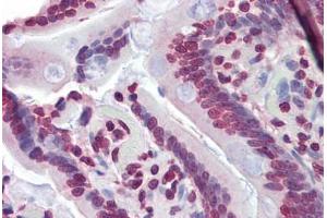 Immunohistochemistry (Paraffin-embedded Sections) (IHC (p)) image for anti-Nuclear Receptor Subfamily 1, Group H, Member 3 (NR1H3) (C-Term) antibody (ABIN462212)