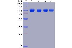 SDS-PAGE (SDS) image for Signal-Regulatory Protein alpha (SIRPA) (AA 31-373) protein (Fc-His Tag) (ABIN6961082)