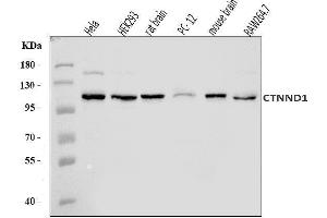 Western blot analysis of delta 1 Catenin/CAS/CTNND1 using anti-delta 1 Catenin/CAS/CTNND1 antibody (ABIN7602221). (CTNND1 antibody  (AA 64-930))