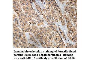 Image no. 1 for anti-ADP-Ribosylation Factor-Like 16 (ARL16) antibody (ABIN1574818) (ARL16 antibody)