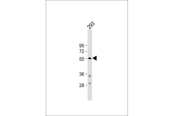 Tryptophan Hydroxylase 1 antibody  (N-Term)