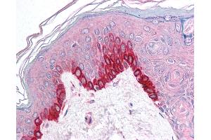 Anti-TRIM9 antibody IHC of human skin. (TRIM9 antibody  (C-Term))
