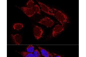 Confocal immunofluorescence analysis of U2OS cells using MTX2 Polyclonal Antibody at dilution of 1:100. (MTX2 antibody)