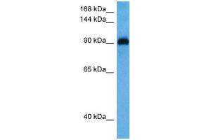 Host:  Rabbit  Target Name:  MYOCD  Sample Tissue:  Mouse Spleen  Antibody Dilution:  1ug/ml (Myocardin antibody  (N-Term))