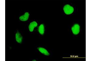 Immunofluorescence of monoclonal antibody to IRF2 on HeLa cell. (IRF2 antibody  (AA 216-315))