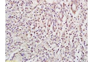 Formalin-fixed and paraffin embedded human gastric tissue labeled with Anti NRSF/REST Polyclonal Antibody,Unconjugated  at 1:200 followed by conjugation to the secondary antibody and DAB staining.