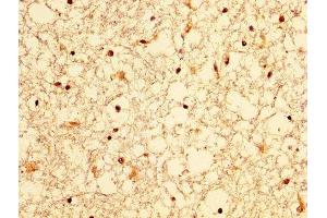 IHC image of ABIN7156316 diluted at 1:300 and staining in paraffin-embedded human brain tissue performed on a Leica BondTM system. (OCRL antibody  (AA 121-271))