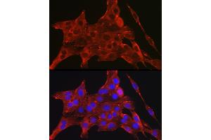 Immunofluorescence (IF) image for anti-Death-Associated Protein Kinase 2 (DAPK2) (C-Term) antibody (ABIN6139403)