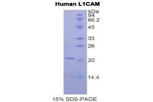 SDS-PAGE (SDS) image for L1 Cell Adhesion Molecule (L1CAM) (AA 526-690) protein (His tag) (ABIN2121503)