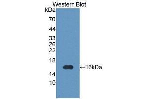 Western blot analysis of the recombinant protein. (PIM1 antibody  (AA 122-261))