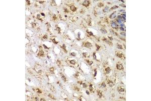Immunohistochemistry (Paraffin-embedded Sections) (IHC (p)) image for anti-serum/glucocorticoid Regulated Kinase 1 (SGK1) (AA 172-431) antibody (ABIN3021291)