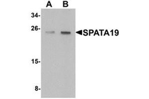 Western blot analysis of SPATA19 in rat lung tissue lysate with SPATA19 antibody at (A) 1 and (B) 2 ug/mL. (SPATA19 antibody  (N-Term))