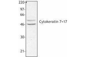 Western Blotting (WB) image for anti-Keratin 7/17 (KRT7/17) antibody (ABIN2664920) (Keratin 7/17 antibody)